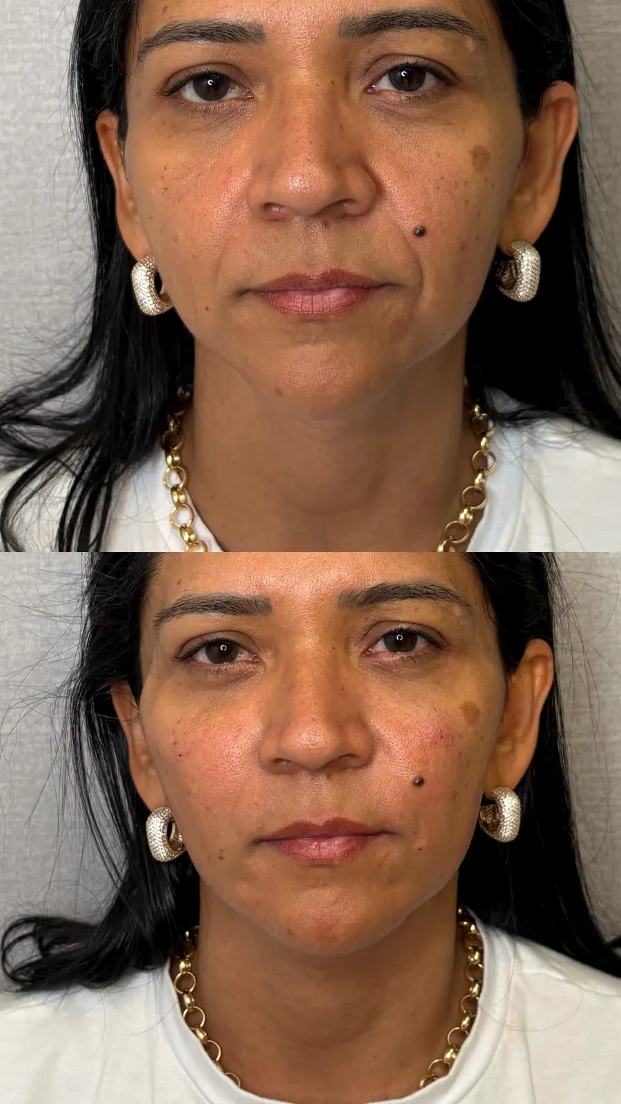Fotos de full face, com o rosto de frente