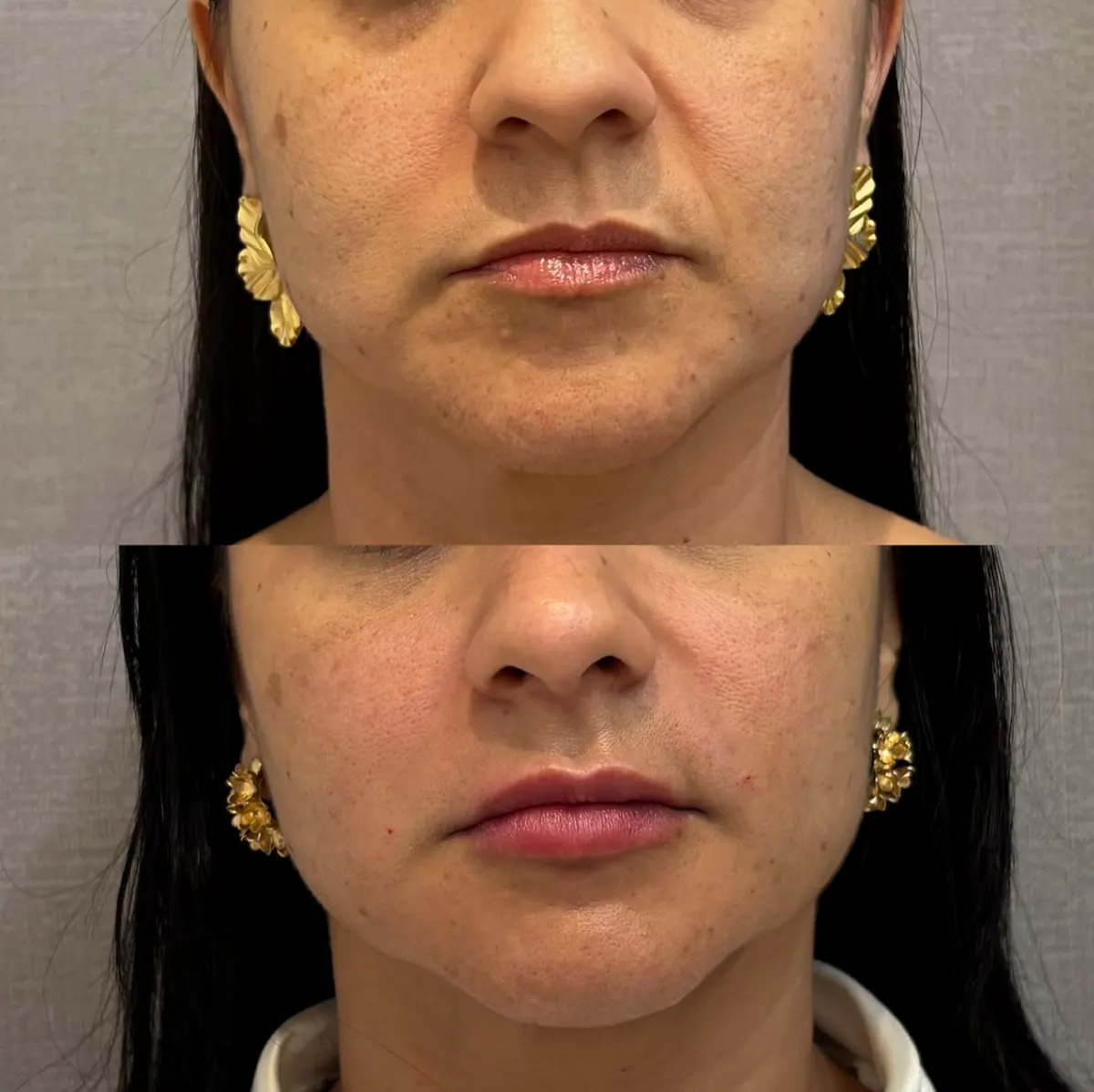 Fotos de full face, com detalhe dos lábios e do queixo