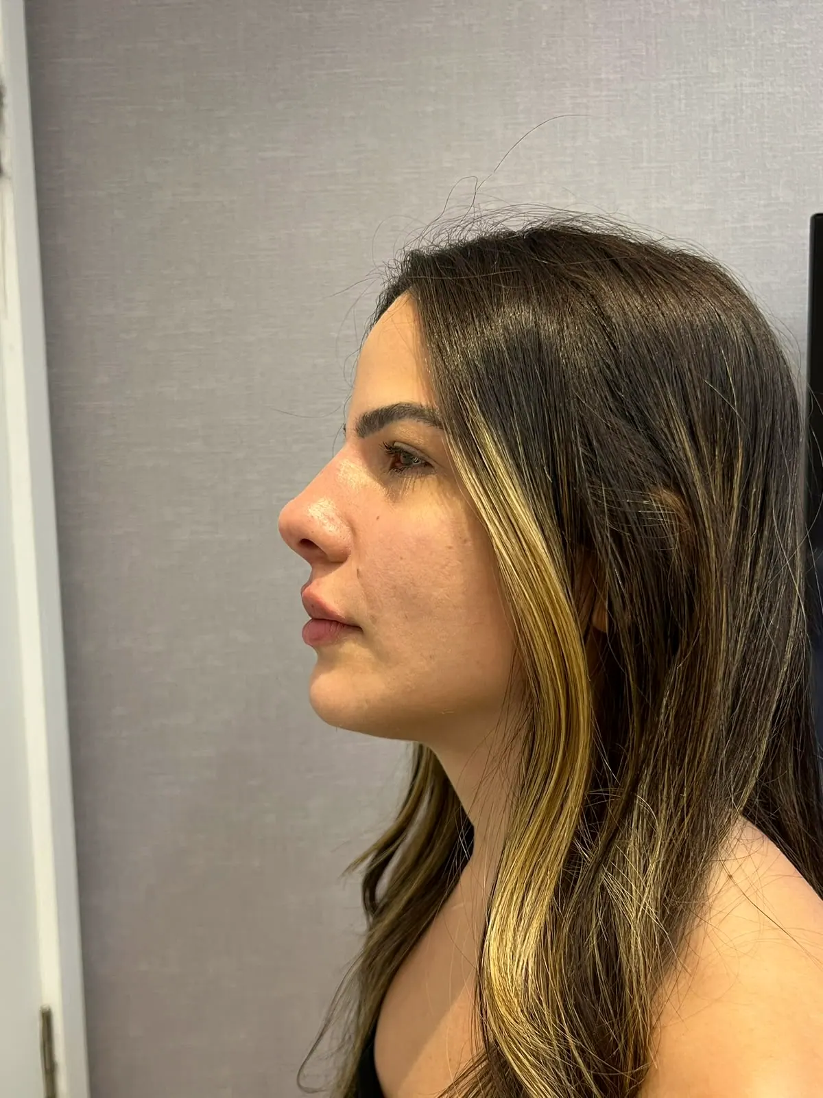 Perfil de uma paciente de cabelos longos, visto de lado